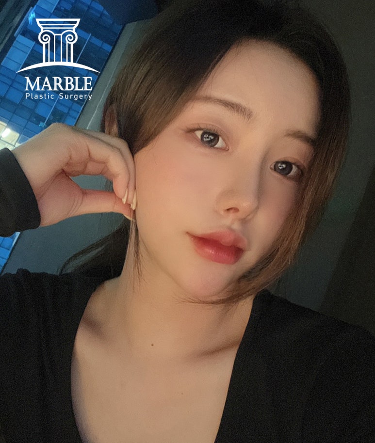 눈재수술 더 신중하게 고민해서 관련 이미지 1