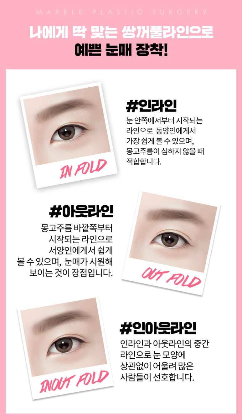 쌍꺼풀수술전후 성공하기 위해서? 관련 이미지 6