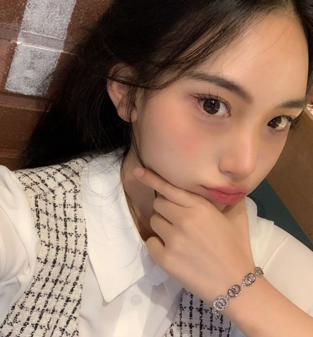 쌍꺼풀풀림 왜 풀리는지 해결 방법은 무엇일까? 관련 이미지 1