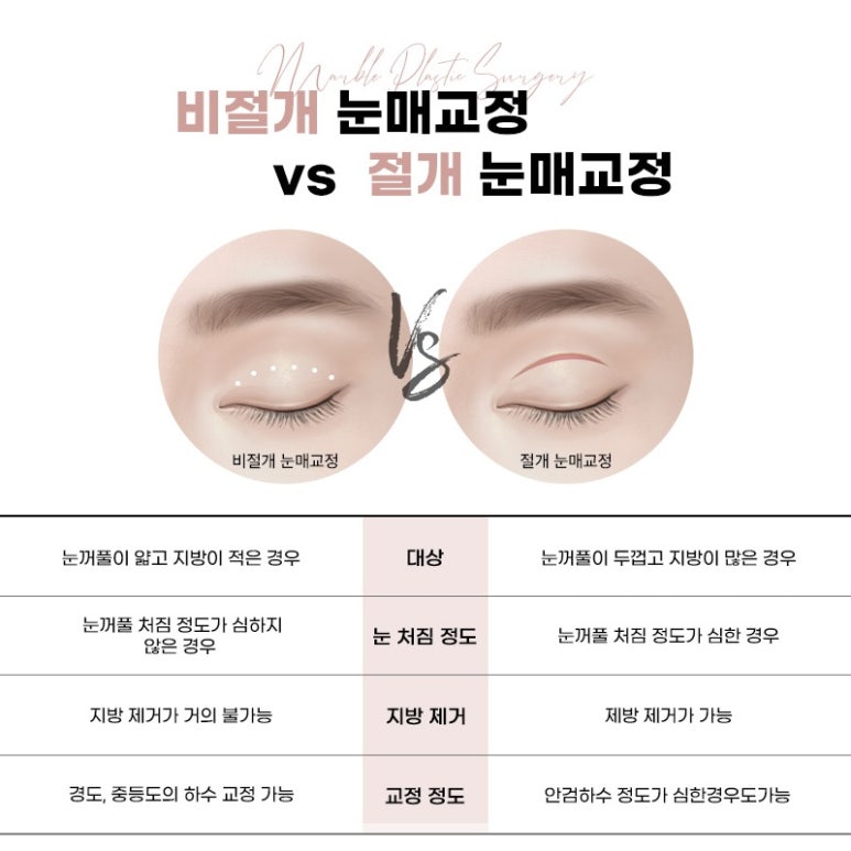 눈성형잘하는곳의 수술과 눈매교정에 대하여 관련 이미지 8
