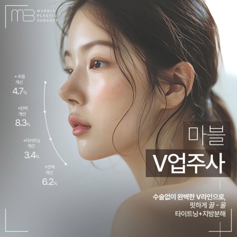 V업주사 마블성형외과 윤곽주사 이벤트기간 공유! 관련 이미지 3