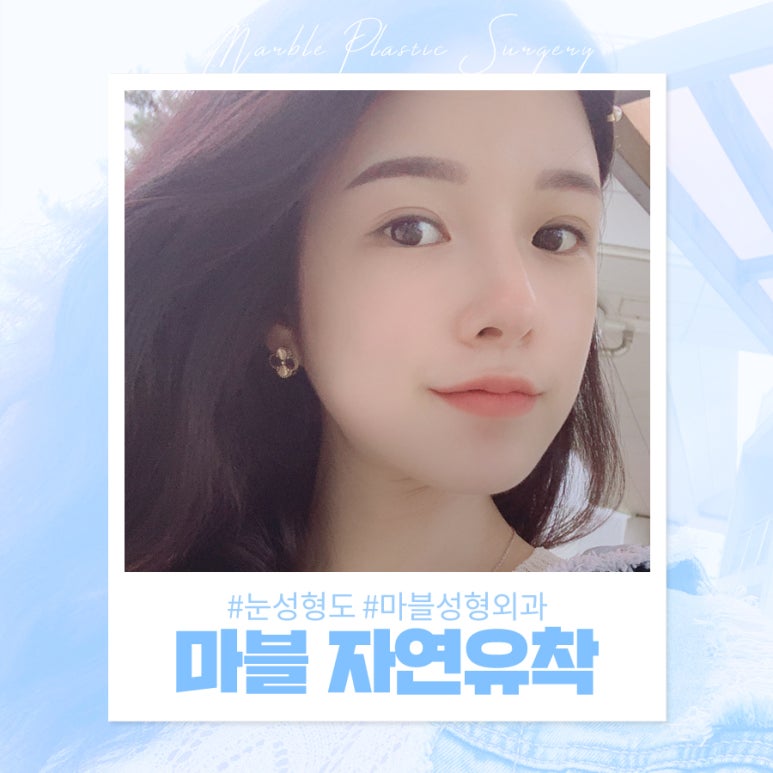 자연유착후기 자연스러워서 맘에 들어요! 관련 이미지 2