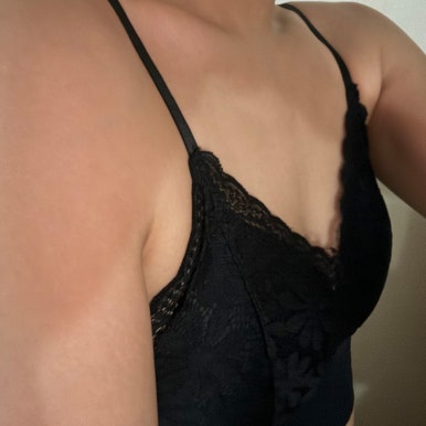 [Gangnam Station Plastic Surgery Clinic Breast Augmentation Review] My Sparse, Uneven Breasts... I Finally Fulfilled My Wish Without Visible Armpit Incision Scars Haha image 4
