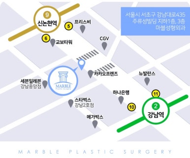 트임수술은 마블성형외과의원 관련 이미지 9