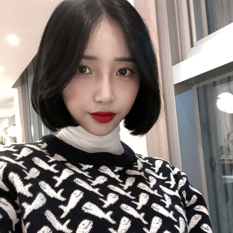 쌍수후기 이것만은 꼭!! 관련 이미지 5