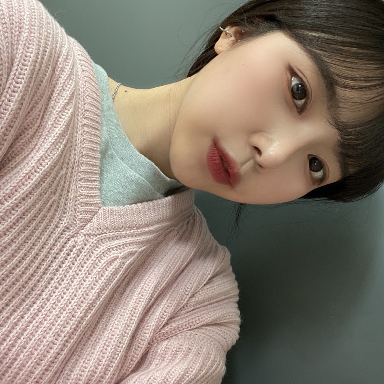 쌍꺼풀수술전후 기대하던 모습으로! 관련 이미지 6