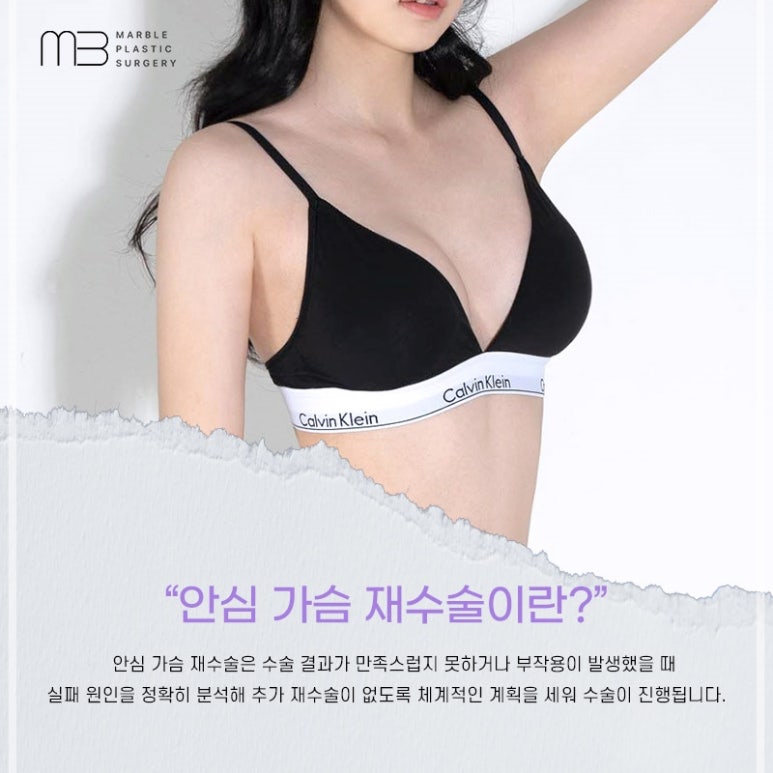 Motiva Breast Revision Surgery Timing and Implant Shape & Height Selection Guide | Marble Plastic Surgery Clinic image 8