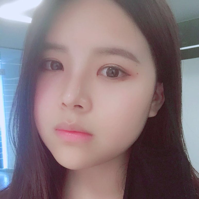 눈성형외과 선택하는 방법! 관련 이미지 1