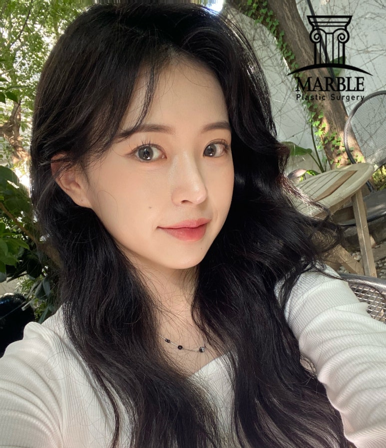 쌍꺼풀수술후기, 자연스러운 변화는 마블성형외과의원! 관련 이미지 1