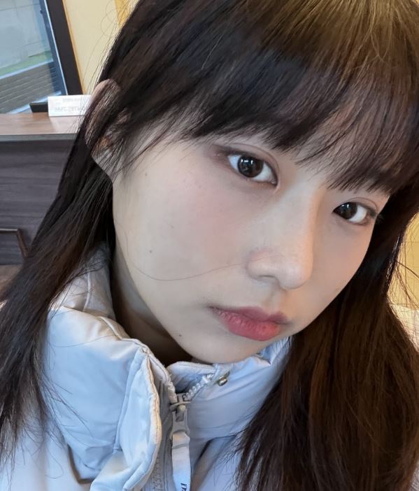 자연유착 쌍꺼풀 인기 많은 이유? 관련 이미지 6