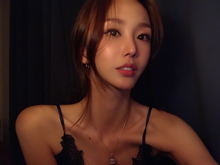 뒤트임수술후기 사람이 달라 보이네 관련 이미지 3