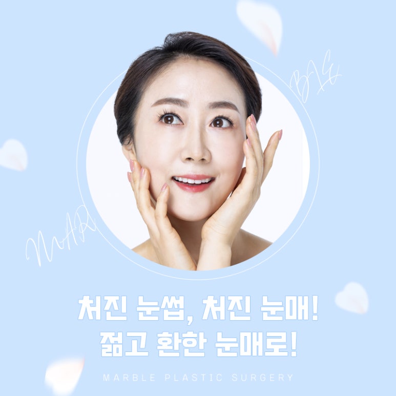 중년눈성형 더 예리하고 젊게 관련 이미지 7