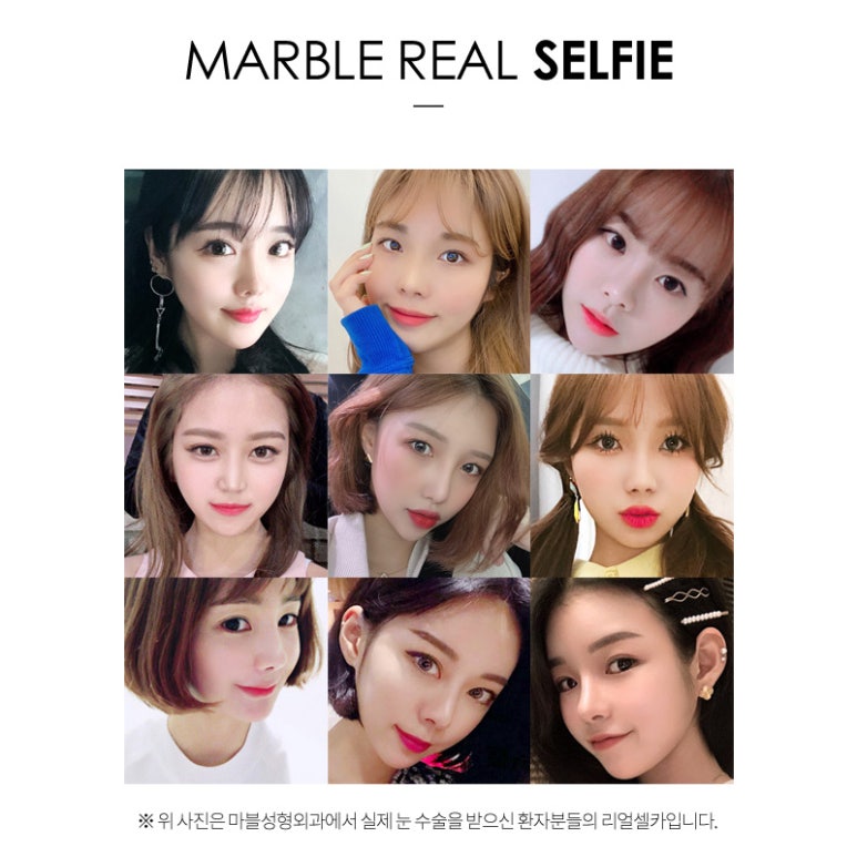 눈매교정 또렷하고 시원한 눈매로! 마블성형외과의원 관련 이미지 13