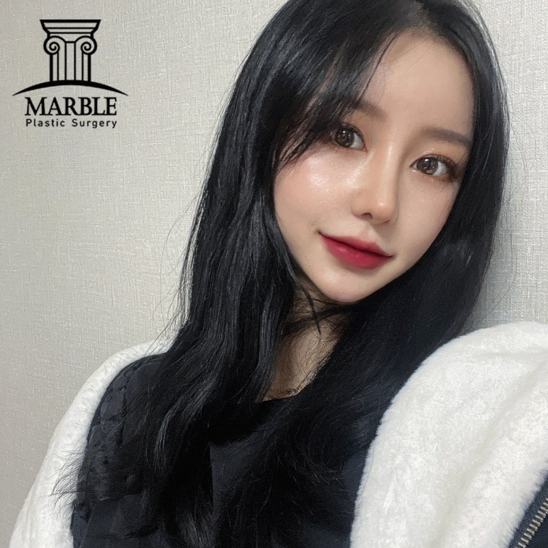 강남역성형외과, 쌍꺼풀후기 첫 눈에 반하는 눈! 관련 이미지 5