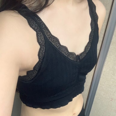 [Gangnam Plastic Surgery Breast Augmentation Review] I was stressed about volume... I found the perfect fit with a ribcage-customized designㅎㅎ image 3