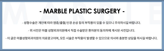 눈성형 눈재수술잘하는병원, 이렇게 준비하세요! 관련 이미지 11