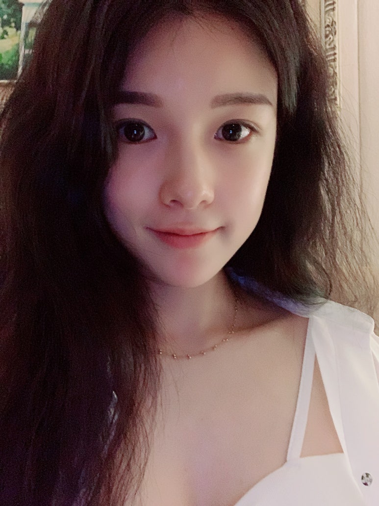 듀얼트임후기 확 달라진 인상! 마블성형외과 관련 이미지 1