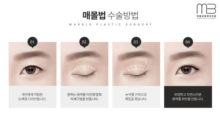 첫쌍수 리얼상세후기 마블 관련 이미지 10