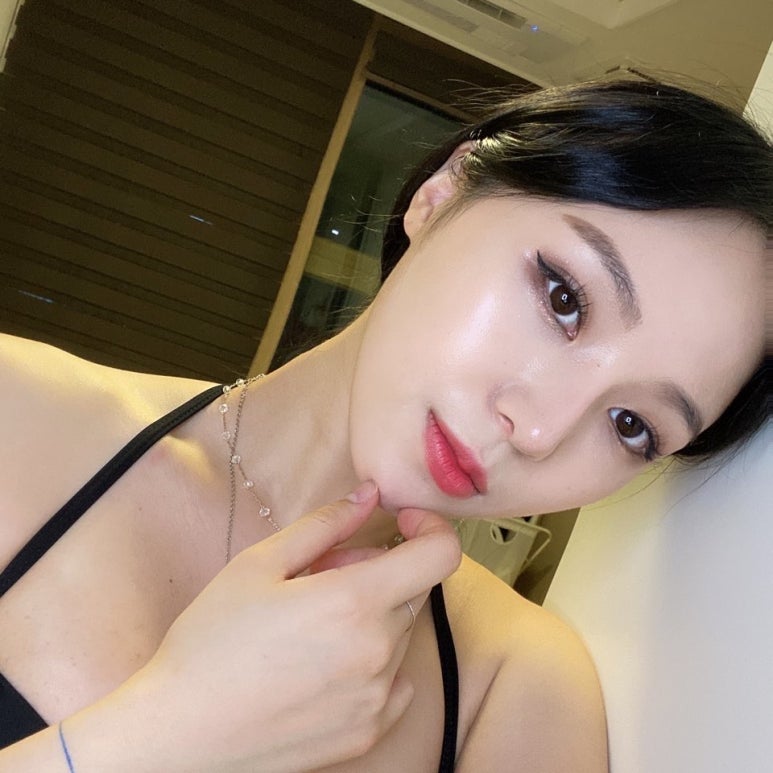 뒷트임밑트임후기 크고 또렷한 눈으로 관련 이미지 7