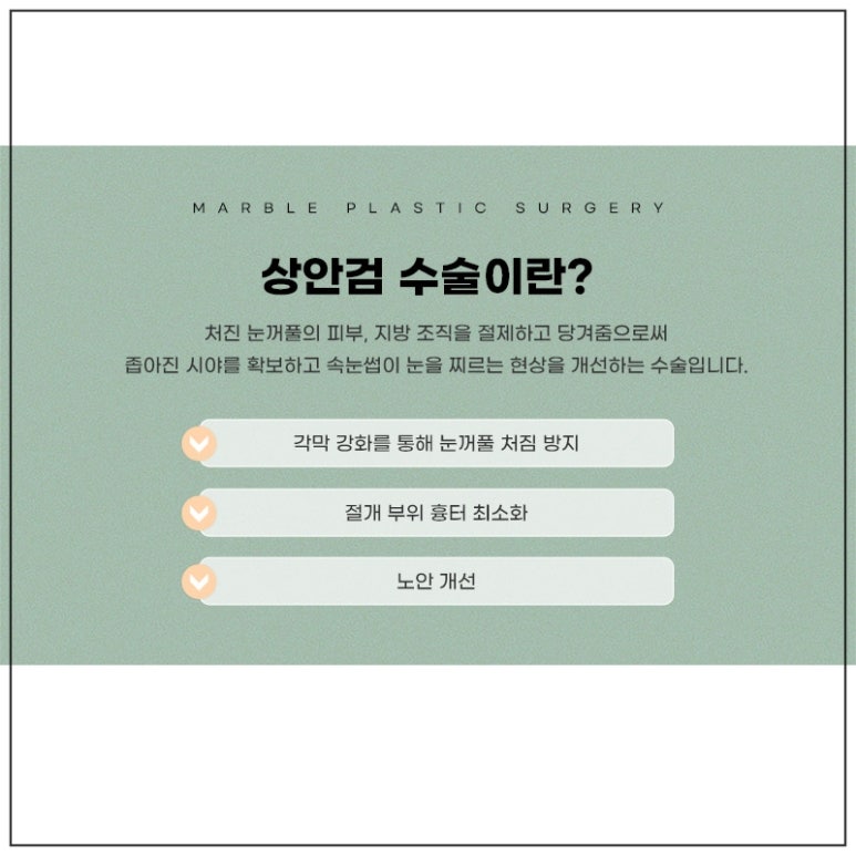 중년눈성형의 필요성과 효과 관련 이미지 2