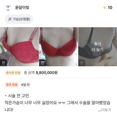 [Gangnam Plastic Surgery Breast Augmentation Real Review] I felt burdened by a large implant because of my slim build, but I found the perfect fit for my body image 1