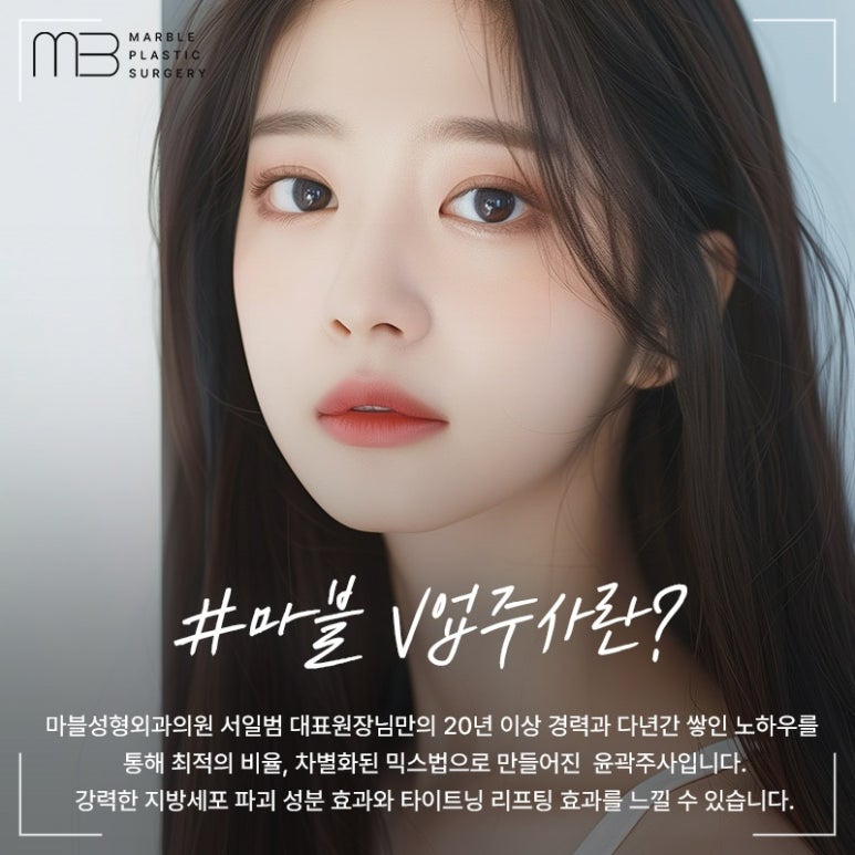 V업주사 마블성형외과 윤곽주사 이벤트기간 공유! 관련 이미지 2
