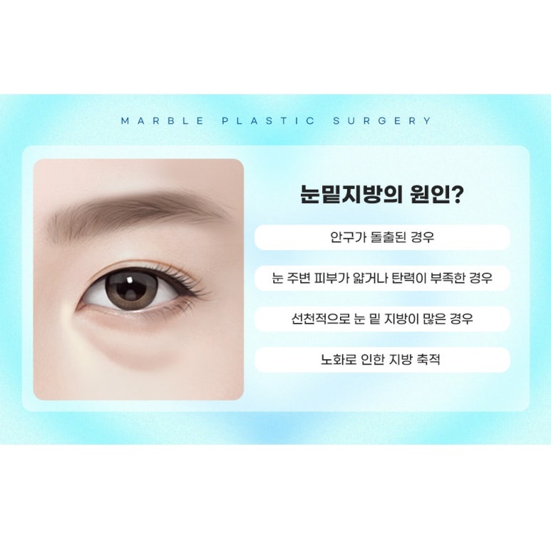 눈밑지방재배치수술 잘하는곳 찾는 기준 관련 이미지 5