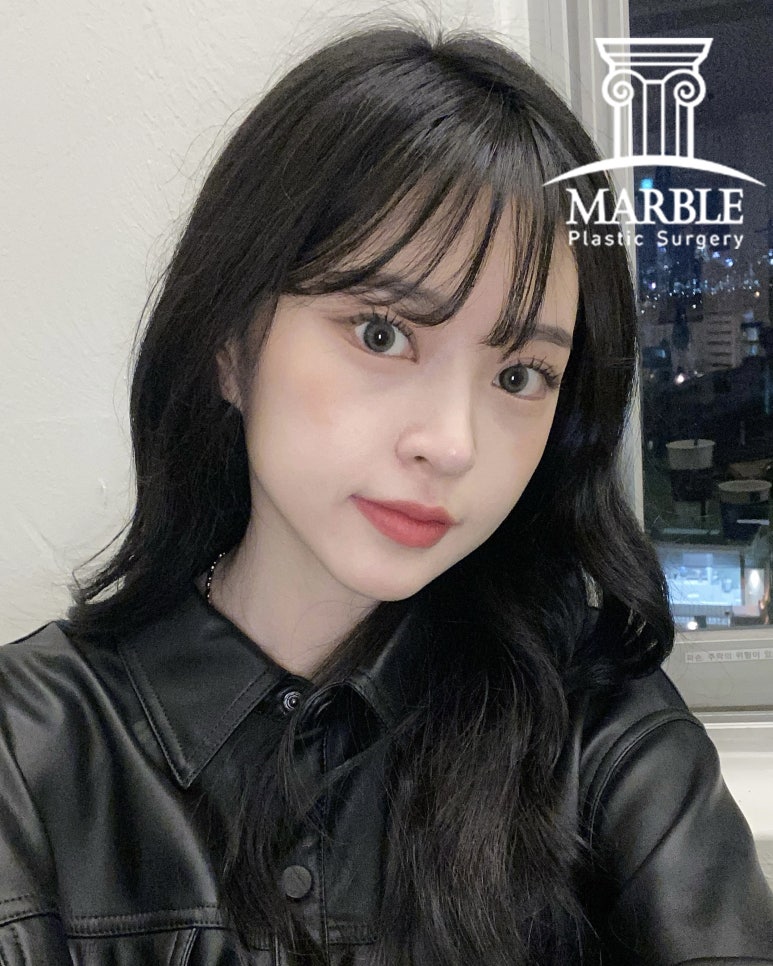 쌍꺼풀수술후기, 자연스러운 변화는 마블성형외과의원! 관련 이미지 5