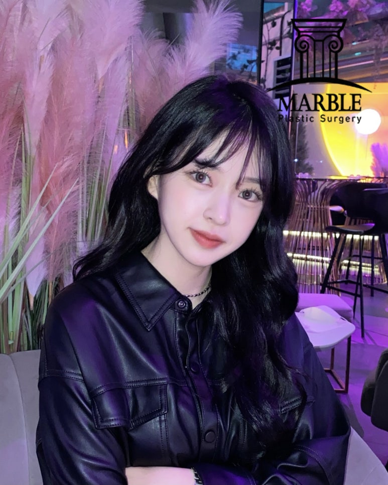 쌍꺼풀수술후기, 자연스러운 변화는 마블성형외과의원! 관련 이미지 7