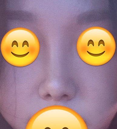 [강남역성형외과 복코성형 후기] 지인들도 부러워하는 매끄러운 코라인, 원장님 덕에 거울 볼 때마다 뿌듯해요 관련 이미지 8