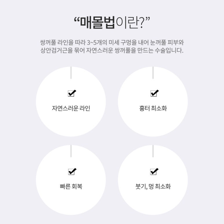 쌍수매몰법 섬세한 디테일로 자연스럽게! 관련 이미지 2