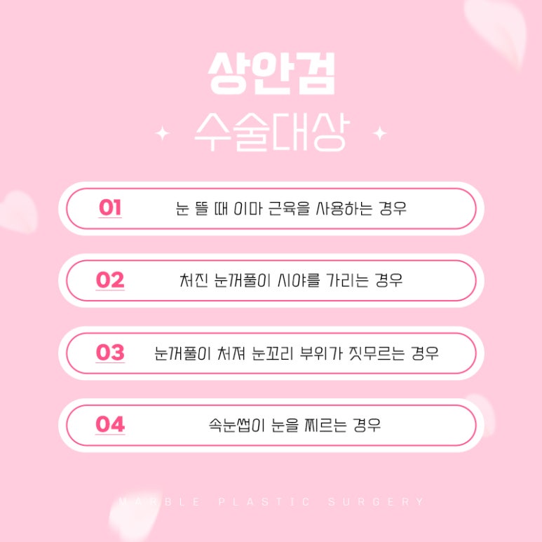 상안검수술비용 따지기 전에 확인하자 관련 이미지 4