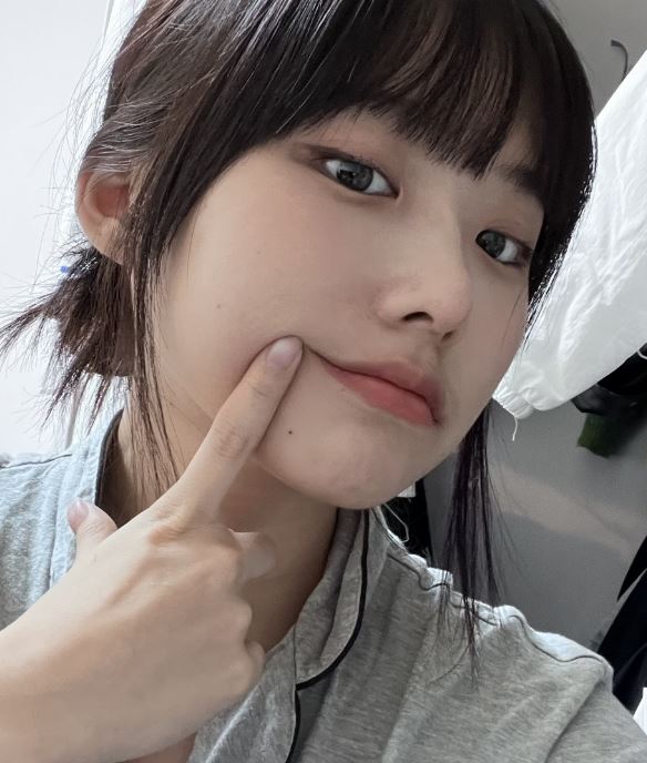 자연유착 쌍꺼풀 인기 많은 이유? 관련 이미지 5