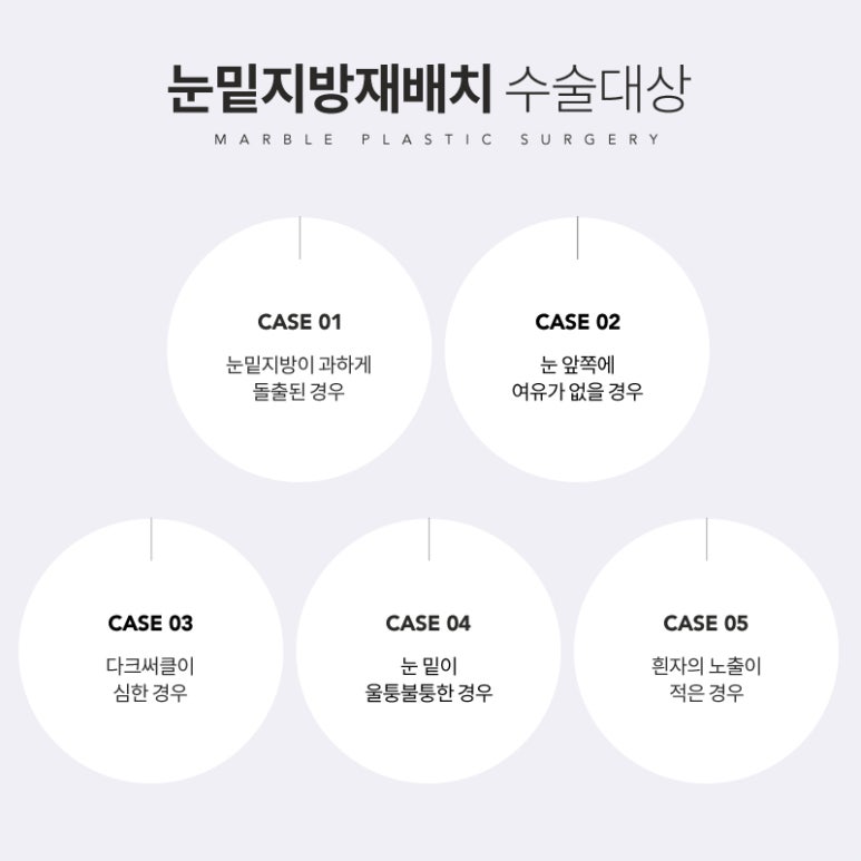 눈밑지방재배치 칙칙한 인상은 그만! 관련 이미지 4