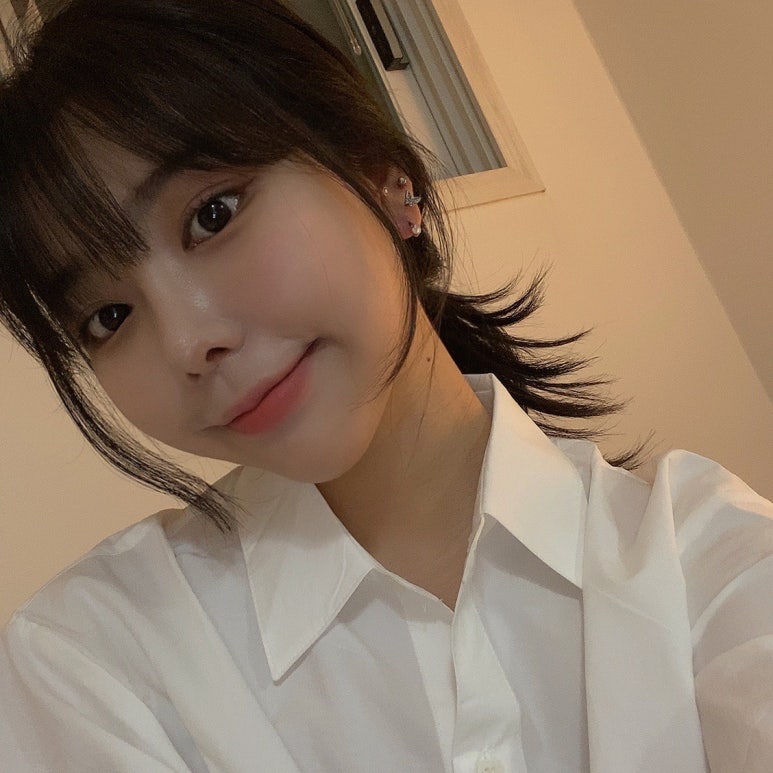 쌍수절개 재수술 알맞게 선택하자 관련 이미지 4