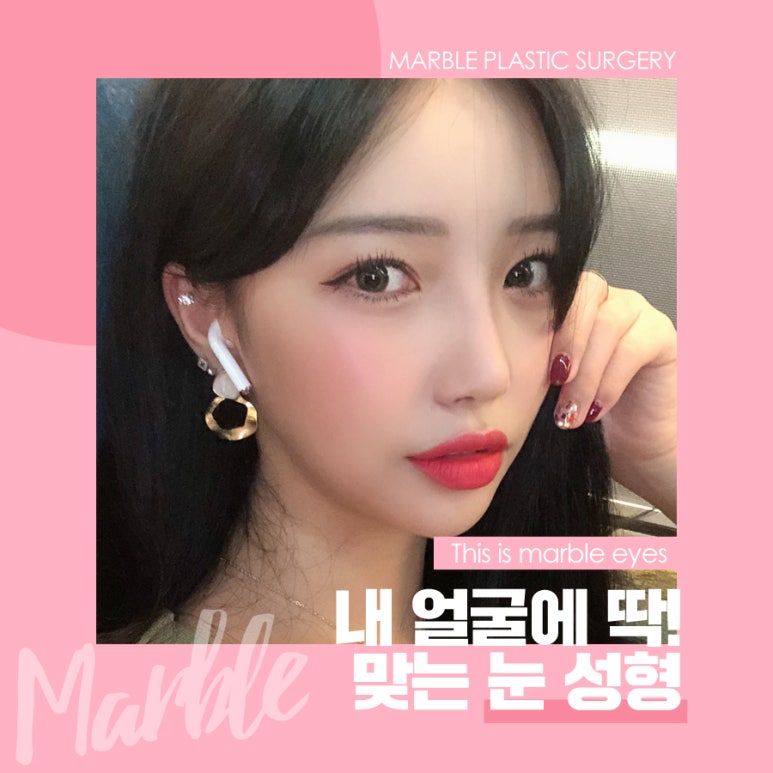쌍꺼풀수술전후 성공하기 위해서? 관련 이미지 2