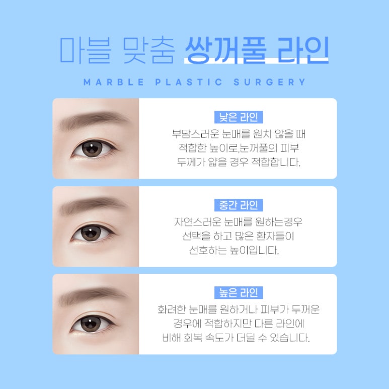 자연유착후기 기대와 현실적인 결과 관련 이미지 3