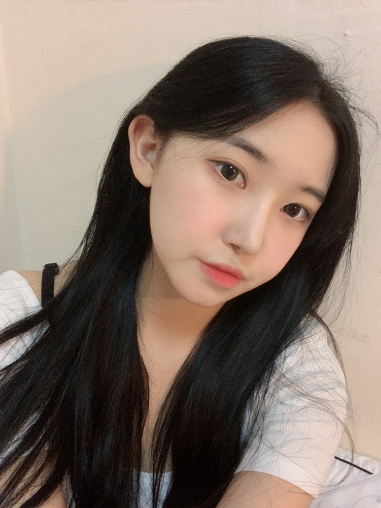 눈성형종류 생각보다 더 다양하다! 관련 이미지 8