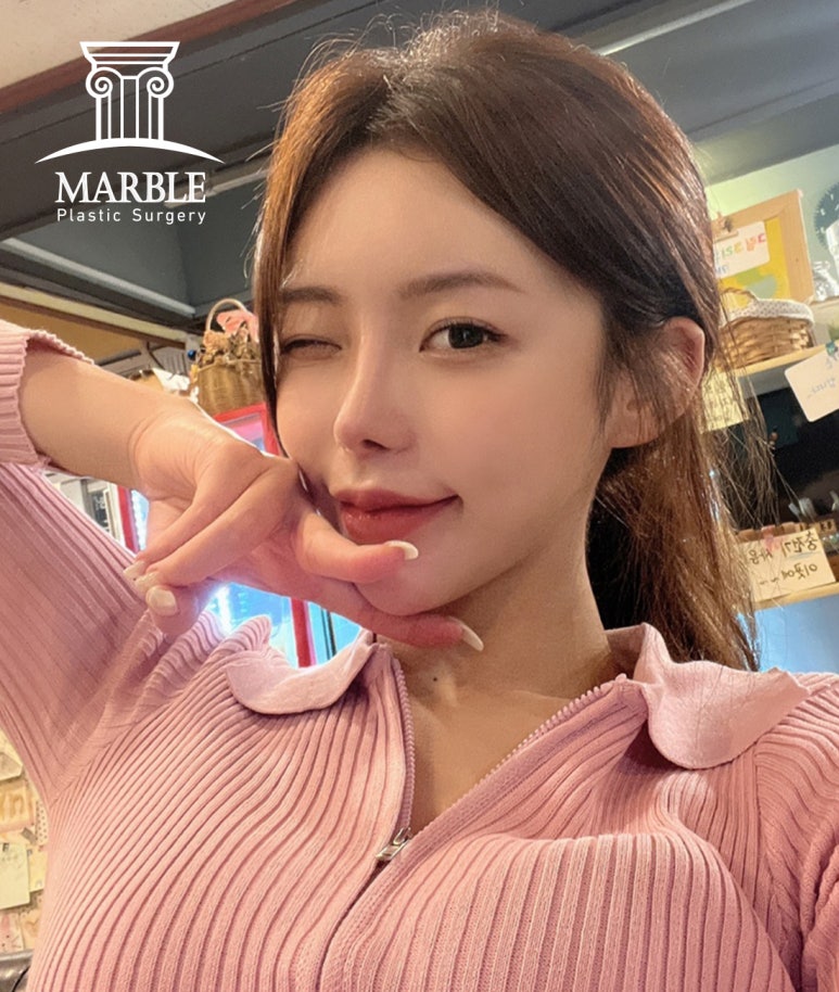 눈재수술 더 신중하게 고민해서 관련 이미지 4