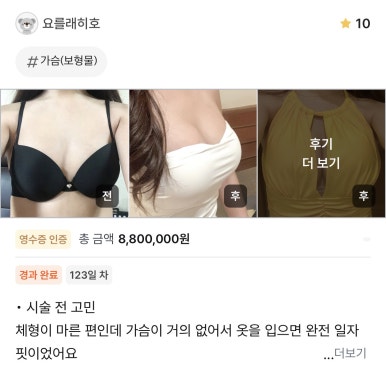 [강남성형외과 가슴성형 후기] 수영복 입을 때 속상했었는데.. 이젠 얇은 티셔츠만 입어도 행복해지네요ㅎㅎ 관련 이미지 1