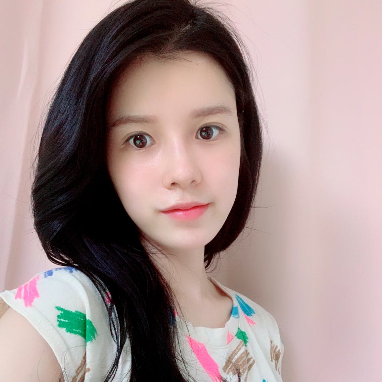 눈재수술비용 알아보고 있다면 관련 이미지 1