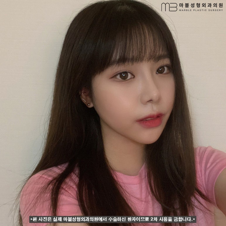 첫쌍수 리얼상세후기 마블 관련 이미지 11