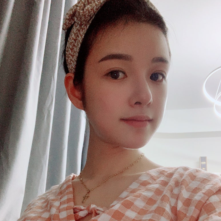 쌍꺼풀수술가격 함께 알아봐요! 관련 이미지 4