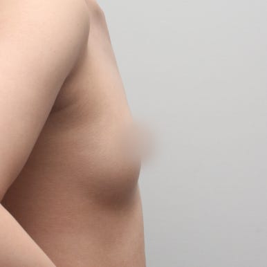 [강남역 성형외과 가슴성형 후기] 빈약한 윗가슴 콤플렉스..짝가슴도 맞춰졌고 촉감까지 완전 찐가슴이에요! 관련 이미지 4