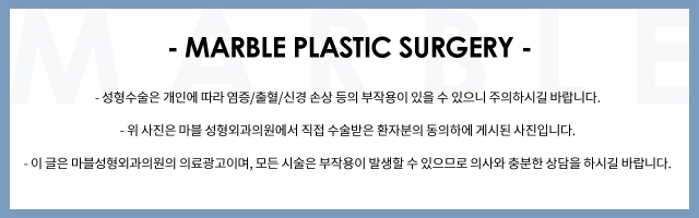 쌍꺼풀수술가격 유형별 기능! 마블성형외과의원 관련 이미지 9