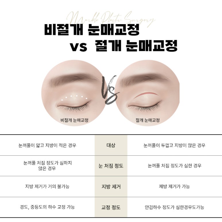 무쌍눈매교정 제대로 된 효과 보려면? 관련 이미지 7