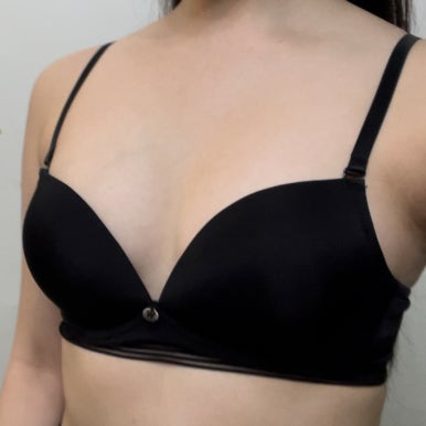 [마블성형외과 가슴성형 후기] 비대칭, 짝짝이 가슴 모양이 스트레스였어요.. 관련 이미지 3