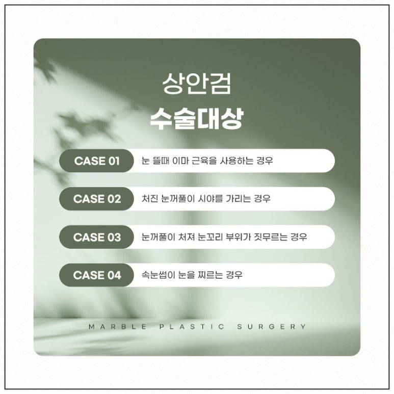 중년눈성형의 필요성과 효과 관련 이미지 3