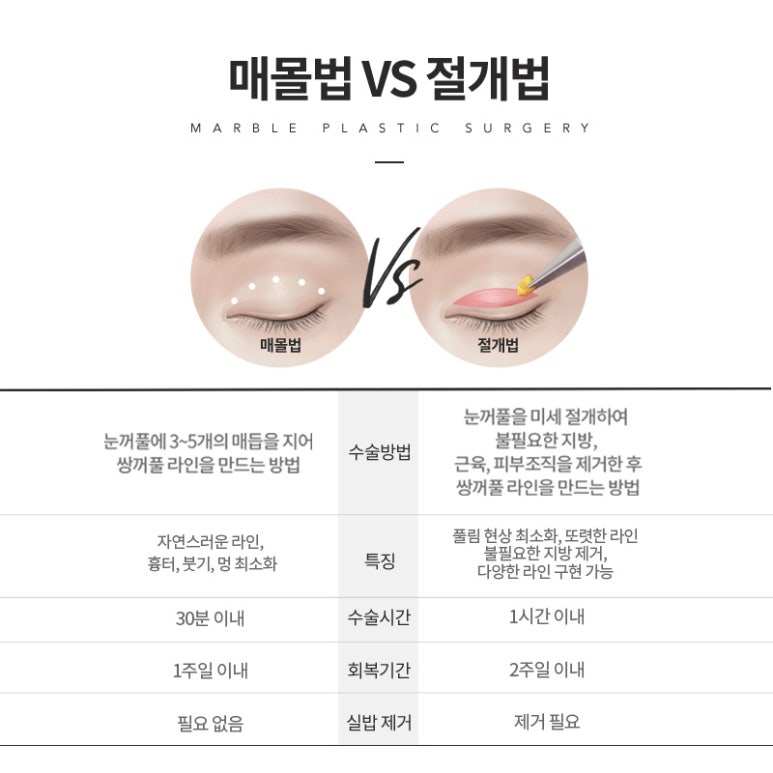 강남쌍수잘하는곳 후회 없는 선택 관련 이미지 3