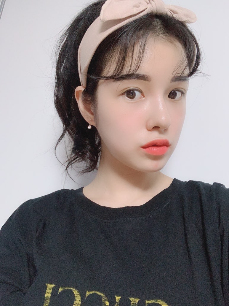 듀얼트임후기 확 달라진 인상! 마블성형외과 관련 이미지 3